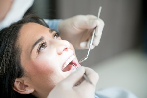 A woman with her mouth opening and having a Teeth Cleaning in Normal IL