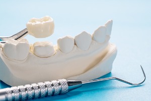 Dental Crown Tools in Bloomington IL