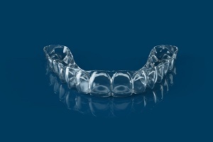 Teeth Aligners in Bloomington IL